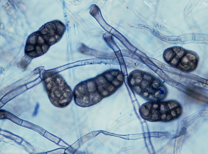 <i><b>Stemphylium vesicarium</b></i> has conidia with rounded ends, echinulate wall, with 2 to 4 constrictions.  They also have a brown hue, a rectangular shape and measure 26-44 x 12-20 µm.  The perfect form of the fungus, <i>Pleospora allii</i> forms on an artificial medium in vitro.  (Stemphyliosis _ gray leaf spot)