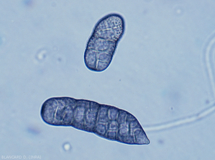 Detail of conidia of <i><b>Stemphylium floridanum</b></i>.  Note their mature appearance.  (Stemphyliosis - gray leaf spot)