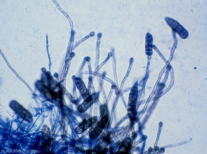 Conidiophores at the end of which septate conidia of <i><b>Stemphylium floridanum</b></i> have formed.(Stemphyliose - gray leaf spot)