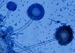 Conidiophres <b><i>Aspergillus</i> sp.</b>