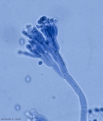 Conidiophore en forme de pinceau de <b><i>Penicillium expansum</i></b> (pourriture à <i>Penicillium</i>).