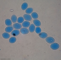 Appearance of several ovoid to piriform sporangia of <b> <i> Plasmopara viticola </i> </b>.  (mildew)