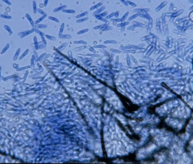 <i><b>Colletotrichum orbiculare</b></i>