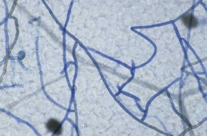 The mycelium of phytopathogenic fungi such as ascomycetes and basidiomycetes (here <i> Rhizoctonia solani </i>), is <b> partitioned </b>.