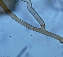 The mycelium of <b> <i> Thanatephorus cucumeris </i> </b> (<i> Rhizoctonia solani </i>) is characterized by its robust appearance, a width between 5 and 15 µm and a dark brown coloration. .  There is also a slight constriction at the lateral ramifications, as well as the presence of partitions.