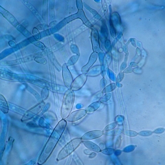 Arrangement of conidia on a conidiophore of <i> <b> Cladosporium cucumerinum </b> </i> (cladosporiosis) 