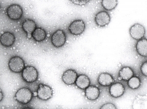 The particles of tomato spotted wilt virus (TSWV) are spherical, 85 nm in diameter. The presence of a lipid envelope gives them a particular aspect.