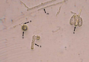 pythium_aphanidermatum