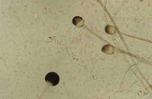 A few sporangiophores of<i> Rhizopus</i> sp. On some of them, the vesicle of the sporagium has torn, releasing many spores.
