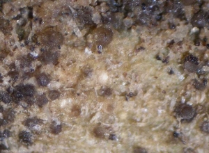 Plusieurs pycnides globuleuses plus ou moins matures parsèment les tissus. <b><i>Didymella lycopercisi</i></b> (taches à <i>Didymella</i>, <i>Didymella</i> leaf spot)v