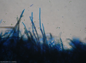 Tortuous conidiophores and young conidia of .<i>Cercospora</i> sp.