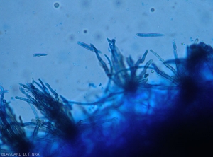 Several clusters of conidiophores and a few conidia are visible under the light microscope on this okra leaf.  <i>Cercospora</i> sp.  