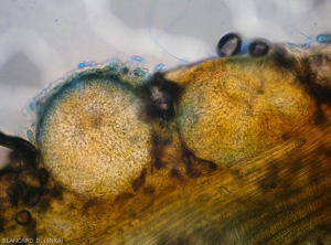 Aspect of fructification of <i>Didymella bryoniae</i> being formed in affected tissues.  (teleomorph form)(black rot, black rot)