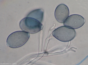 Detail of more or less melanized sporangia observed under a light microscope.  <i>Pseudoperonospora cubensis</i> (downy mildew)