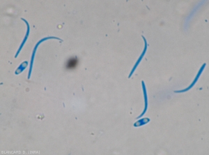 Detail of alpha and beta spores of <b><i>Phomopsis vexans</i></b>.