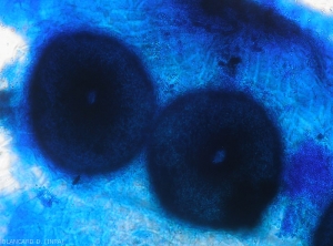 Aspect under the light microscope of 2 pycnidia of <b><i>Phomopsis vexans</i></b> formed on altered tissues.  Notice an ostiole present on each of them.
