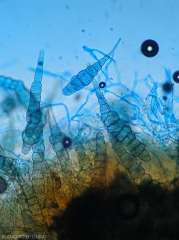 Appearance of several <i>Alternaria brassicicae</i> conidia on a leaf lesion;  this is another species affecting cabbage which seems less common in the tropics (cabbage alternaria)