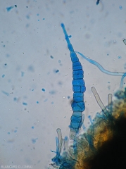 Detail of a conidium of <i>Alternaria brassicicae</i>.  Note that it is rather slender and has a longer appendage.  (alternaria cabbage)