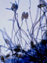 Conidiophores bearing conidia isolated from <b><i>Stemphylium solani</i></b>.  (Stemphyliosis - gray leaf spot)