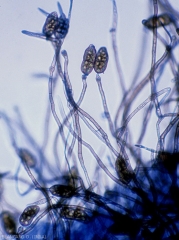 Conidiophores bearing conidia isolated from <b><i>Stemphylium solani</i></b>.  (Stemphyliosis - gray leaf spot)