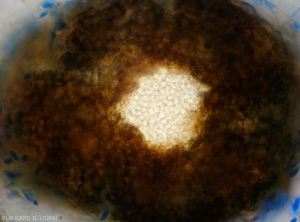 Detail of a <b> <i> Phomopsis viticola </i> </b> pycnidia.  We can clearly see the ostiole and the mass of hyaline conidia within this structure.