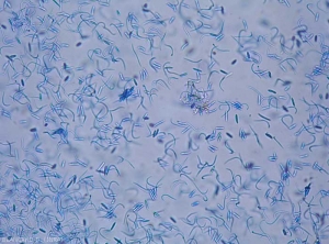 Mixture of beta spores and less alpha spores of <b> <i> Phomopsis viticola </i> </b> 