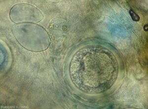 Detail of an oospore of <i> Plasmopara viticola </i> compared to two sporangia located on the left in the photo.  <b> downy mildew </b>.