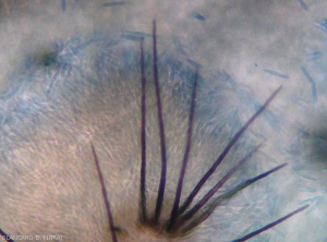 Observation under a light microscope makes it easier to distinguish an acervulus.  It has several brown, septate bristles and the spores are clumped together in the form of mucus.  <i><b>Colletotrichum</i> sp.</b>(anthracnose)