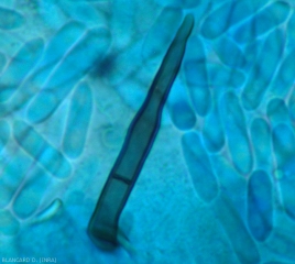 Detail of a bristle or setae and numerous conidia formed by the acervulus.  This seta shows a transverse septum.  <i><b>Colletotrichum</i> sp.</b> (anthracnose)