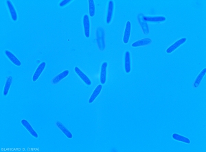 Detail of cylindrical <i><b>Colletotrichum</i> sp.</b> conidia.  (anthracnose)