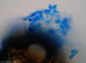 Conidia have been extruded from the ostiole, some are bicellular and characteristic.  <b><i>Phoma cucurbitacearum</i></b> (anamorph form)(black rot)