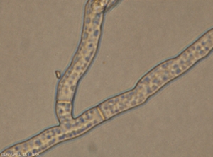 We also note on the mycelium of <i><b>Rhizoctonia solani</i></b> a slight constriction at the level of the lateral ramifications, as well as the presence of partitions.