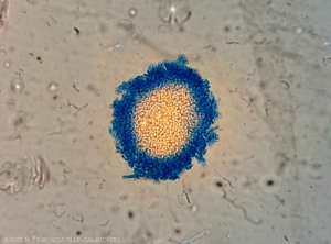 Cluster of pycnidiospores emerging from a pycnidia of a <i><b>Phoma</i> sp.</b> responsible for the sifting of taro.