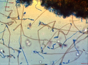Microscopic observation of sporulations of <i><b>Cladosporium colocasiae</b></i>: the conidia, lighter than the conidiophores, take on a partial "cotton blue" colour.  Note the conidia of various shapes, in short chains.  Some are compartmentalized.