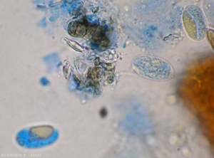 Aspects of asc ospores under a light microscope of <b><i>Erysiphe necator</i></b>.