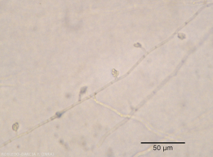 Appearance of microconidia of <b><i> Fusarium oxysporum </i> f.  sp.  <i> melongenae </i></b> clustered in a false head at the end of short monophialid conidiophores. 