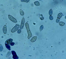 Numerous irregular conidia, sometimes septate and brownish, are observed on the leaf blade.  <b> <i> Passalora fulva </i> </b> (cladosporiosis, leaf mold)