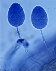 Two sporangia of <i> Phytophthora cryptogea </i> formed on the outside of this necrotic and rotten tomato root, taken from a soilless crop.  Usually the sporangia of <i> Phytophthora </i> spp.  are formed more readily in the tissues.  <b> <i> Phytophthora </i> spp.  </b> (root and basal rots, foot and root rot, buckeye rot)