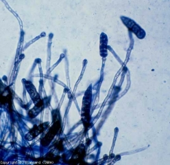 Olive-colored and with a swollen apex, these conidiophores are septate and measure 75-300 µm x 3-5.5 µm.  The conidia are also pointed but they are longer than those of <i> Stemphylium solani </i>.  <b> <i> Stemphylium lycopersici </i> </b> (<i> S. floridanum </i>, stemphyliosis, gray leaf spot)