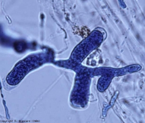 Filamentous sporangia of <b><i>Pythium aphanidermatum</i></b> . 