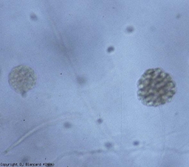 Filamentous sporangium of <b> <i> Pythium </i> sp. </b> containing several zoospores.