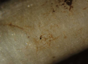 Careful observation of healthy tissue near diseased tissue reveals the characteristic brown mycelium of <b> <i> Thanatephorus cucumeris </i> </b> (<i> Rhizoctonia solani </i>, " damping-off "," bottom rot ")