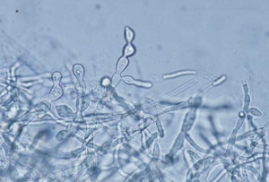 Keg-shaped articles can be seen on the mycelium;  they are considered to be blank sclerotia.  <b> <i> Thanatephorus cucumeris </i> </b> (<i> Rhizoctonia solani </i>, "damping-off", "bottom rot")