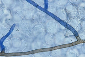 The mycelium of <b> <i> Thanatephorus cucumeris </i> </b> (<i> Rhizoctonia solani </i>, "damping-off", "bottom rot") is characterized by its robust appearance, between 5 and 15 µm and a dark brown color.  There is also a slight constriction at the side ramifications as well as the presence of partitions.