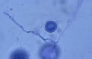 Its oogonia are spherical, smooth-walled, often fertilized by 1 to 2 antheridia, most often monoclines (14-17 µm).  They give rise to thick-walled plerotic oospores.  <b> <i> Pythium tracheiphilum </i> </b> ("lettuce stunt")