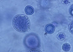 <b> <i> Pythium tracheiphilum </i> </b> ("lettuce stunt") produces globular to subglobular, intercalary or terminal sporangia, varying in diameter from 22 to 34 µm.