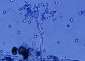 The shrub sporangiophores of <b> <i> Bremia lactucae </i> </b> (downy mildew) emerge through the stomata.  They have rather spherical sporangia at the end of sterigmas.