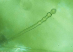 Detail of a young conidiophore producing its first conidia.  <b> <i> Golovinomyces cichoracearum </i> var.  <i>cichoracearum</i> </b> (powdery mildew)
