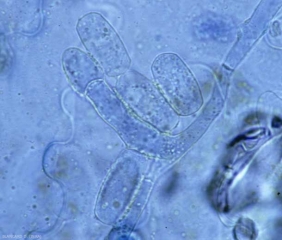 <b> <i> Golovinomyces cichoracearum </i> var.  <i>cichoracearum</i> </b> (powdery mildew) in its imperfect form commonly produces chains of hyaline, cylindrical to doliform conidia (25-45 x 14-26 µm), located at the end of short conidiophores.