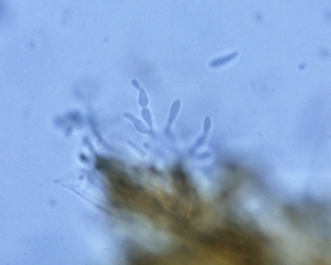 Microdochium453